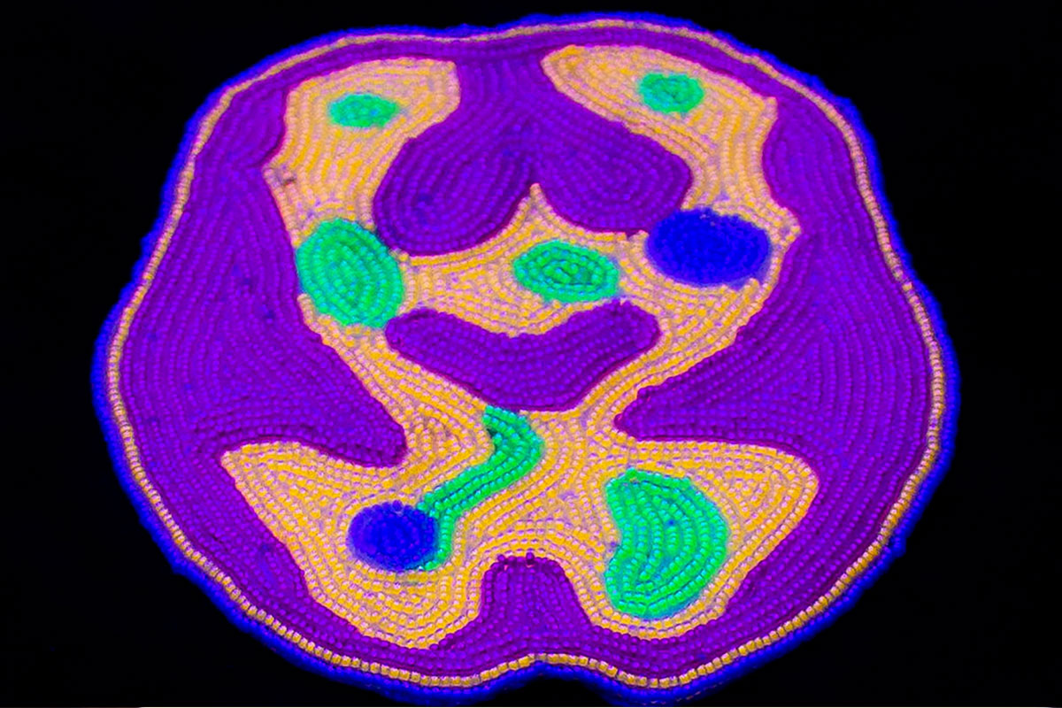 Neurotransmitting